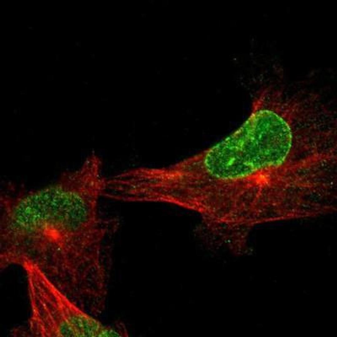 Immunocytochemistry/Immunofluorescence: Nesprin 2 Antibody [NBP1-84190] - Staining of human cell line U-251MG shows positivity in nucleus & nuclear membrane.