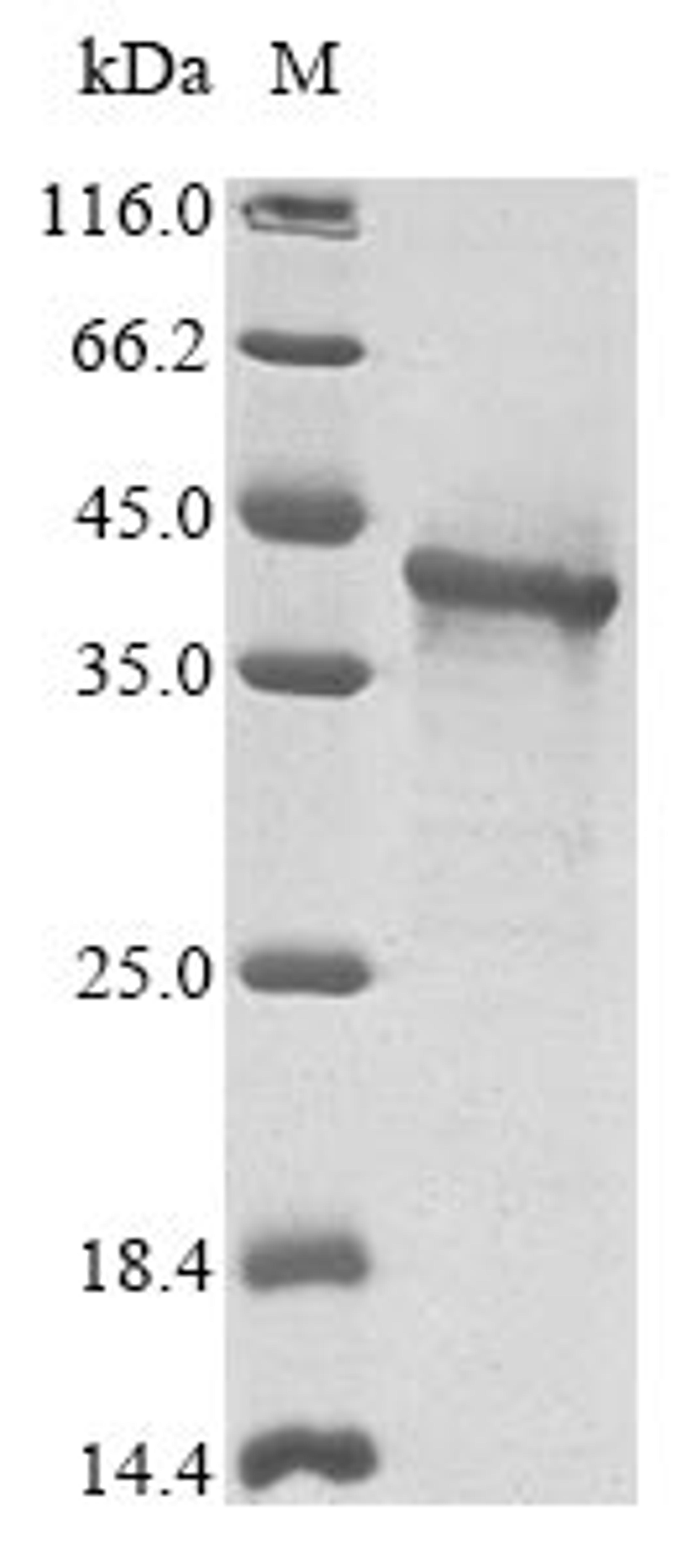 (Tris-Glycine gel) Discontinuous SDS-PAGE (reduced) with 5% enrichment gel and 15% separation gel.