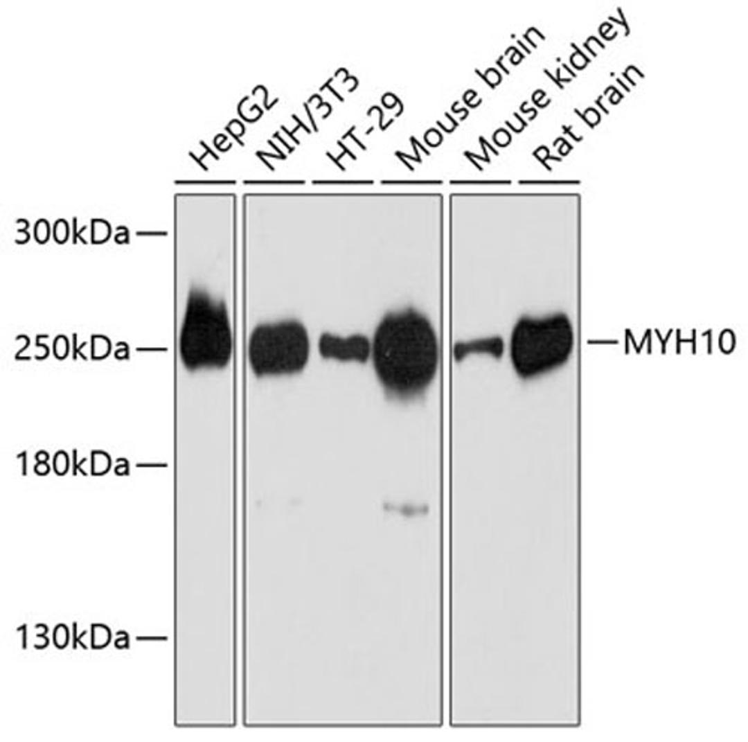 Western blot - MYH10 antibody (A12029)