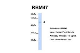 Western Blot: RBM47 Antibody [NBP1-57559] - Human Fetal Muscle, Antibody Dilution: 1.0 ug/ml.