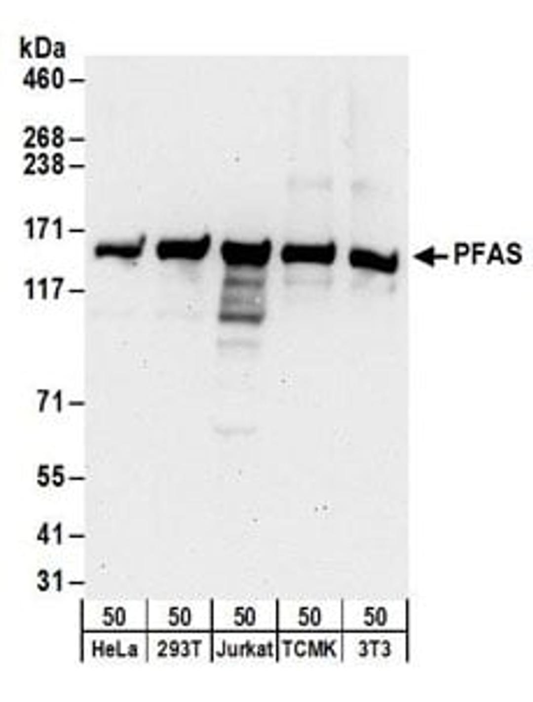 Detection of human and mouse PFAS by western blot.