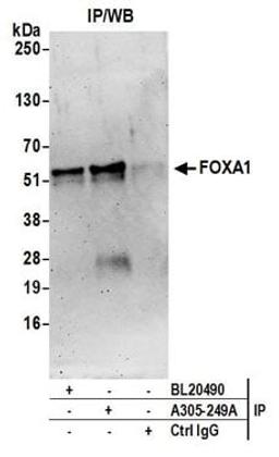 Detection of human FOXA1 by western blot of immunoprecipitates.