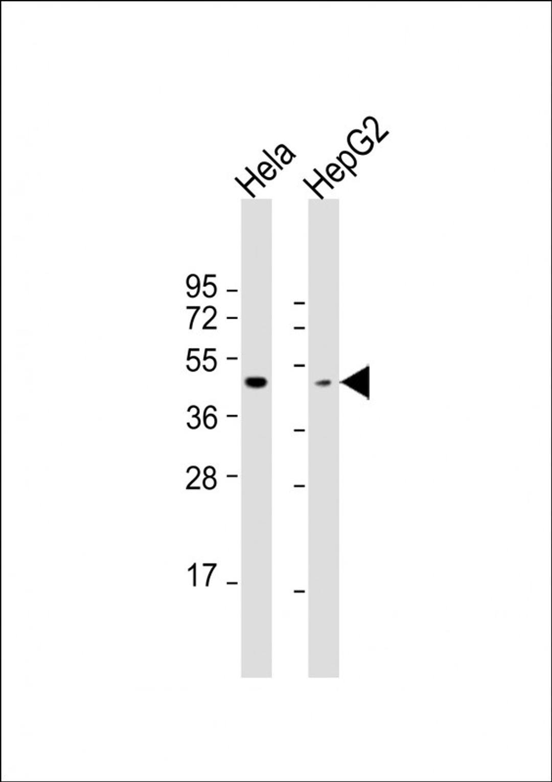 Western Blot at 1:1000 dilution Lane 1: Hela whole cell lysate Lane 2: HepG2 whole cell lysate Lysates/proteins at 20 ug per lane.