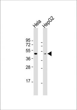 Western Blot at 1:1000 dilution Lane 1: Hela whole cell lysate Lane 2: HepG2 whole cell lysate Lysates/proteins at 20 ug per lane.