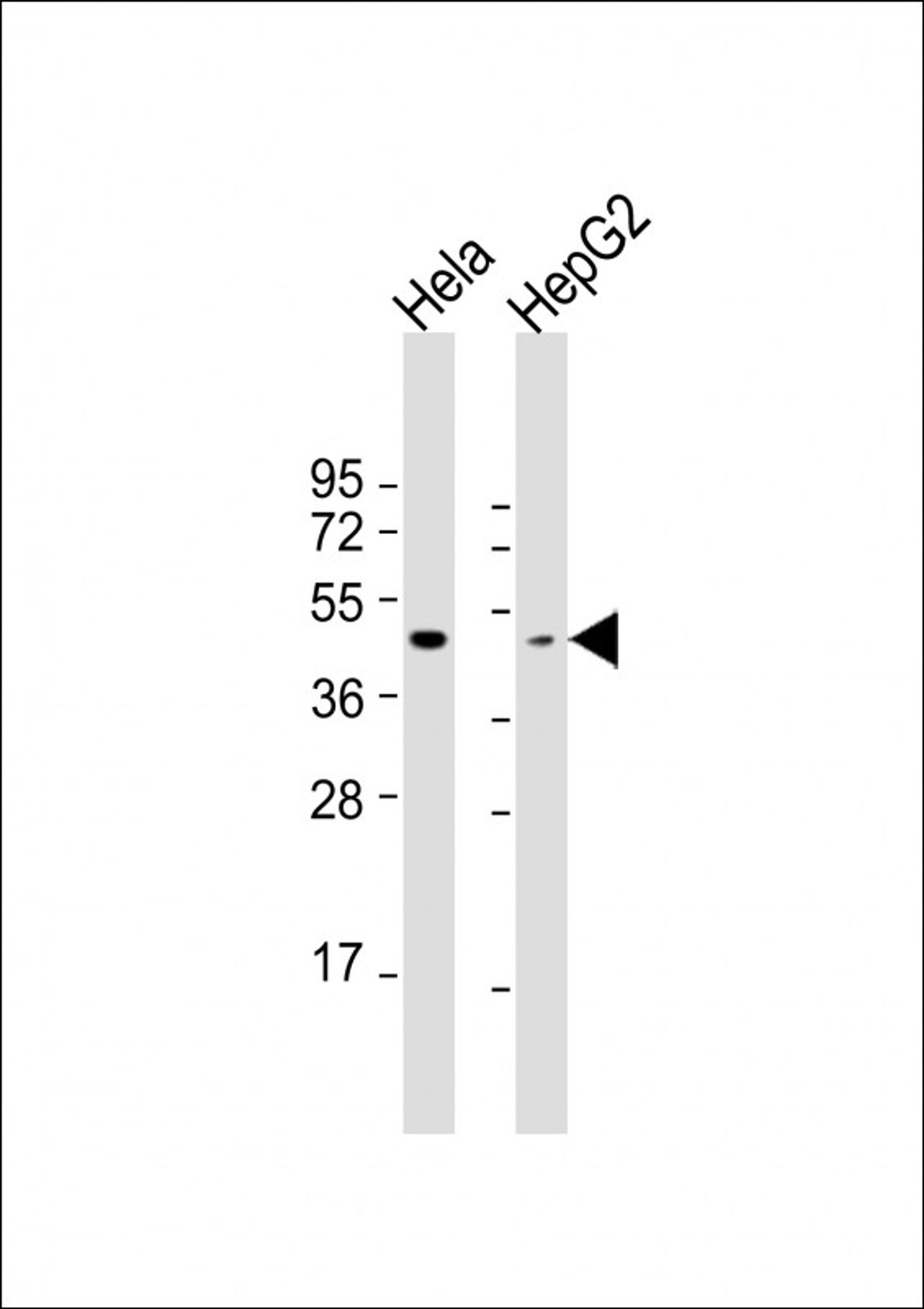 Western Blot at 1:1000 dilution Lane 1: Hela whole cell lysate Lane 2: HepG2 whole cell lysate Lysates/proteins at 20 ug per lane.