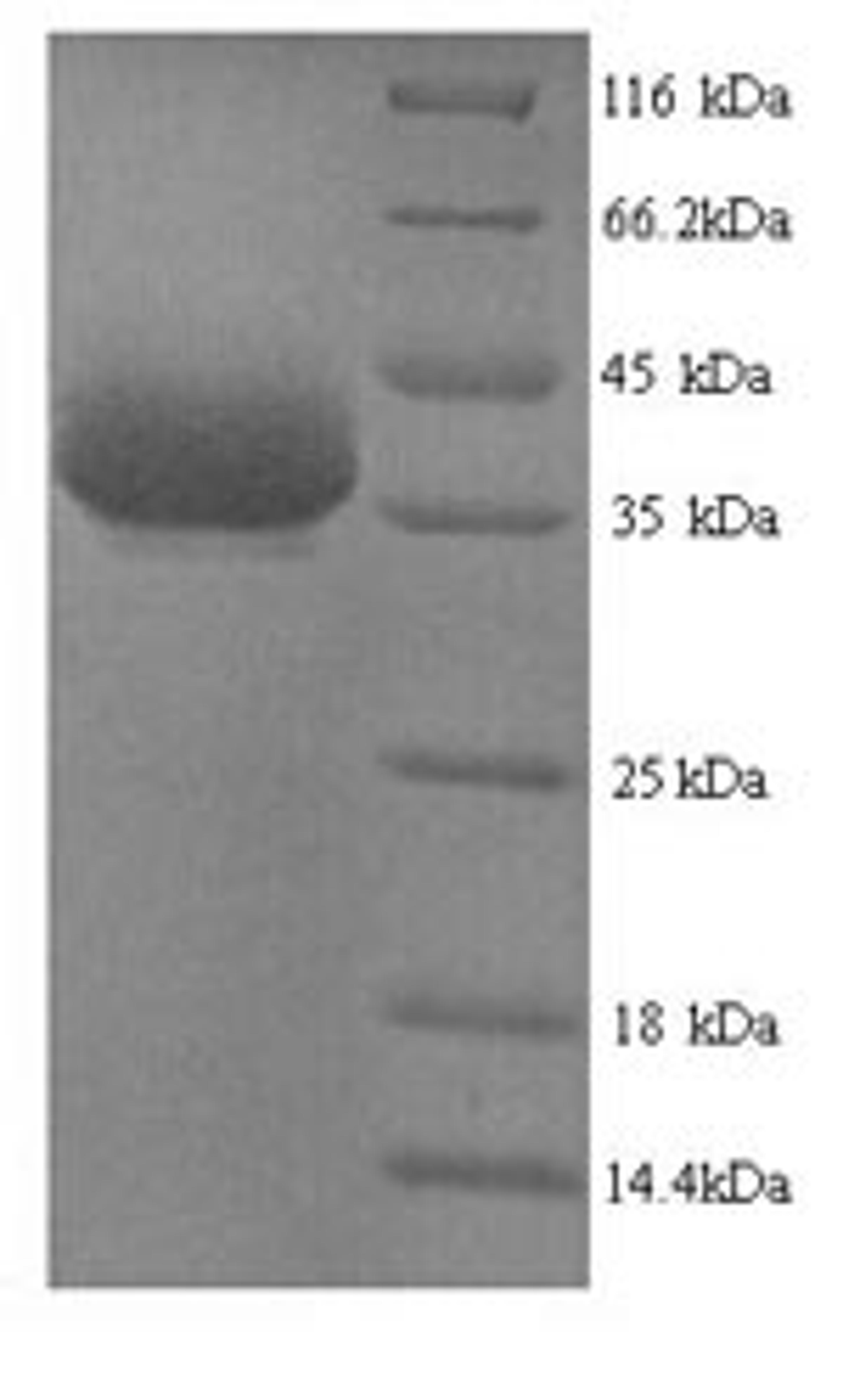 (Tris-Glycine gel) Discontinuous SDS-PAGE (reduced) with 5% enrichment gel and 15% separation gel.