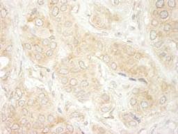 Detection of human DDX19 by immunohistochemistry.