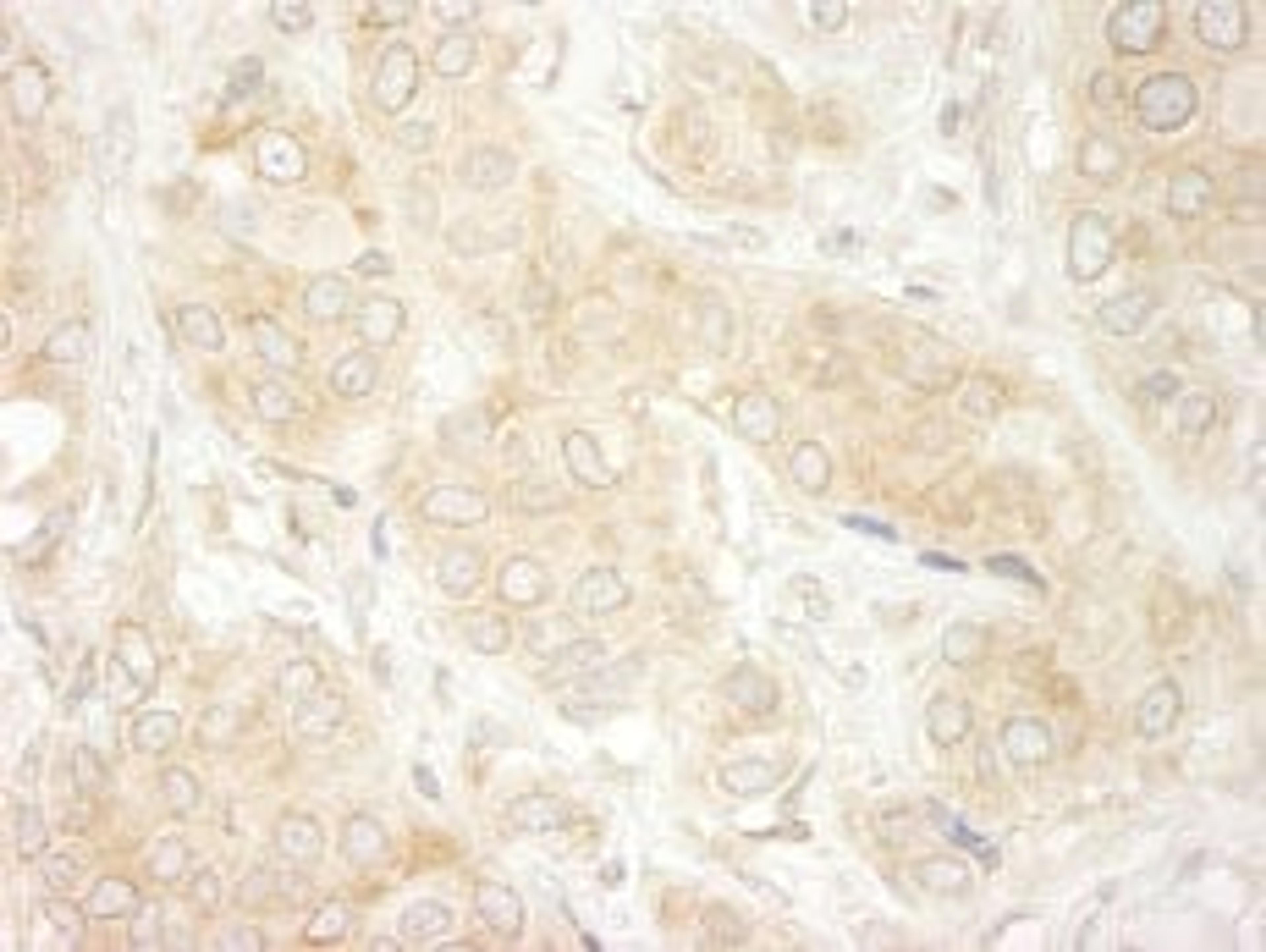 Detection of human DDX19 by immunohistochemistry.