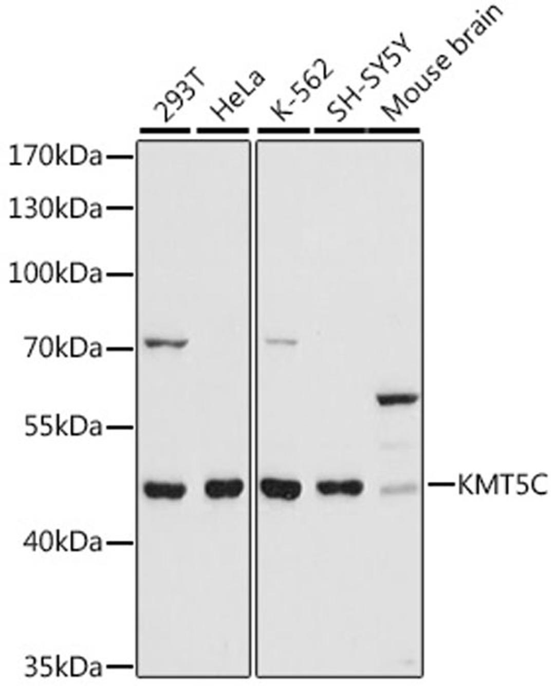 Western blot - KMT5C antibody (A16235)