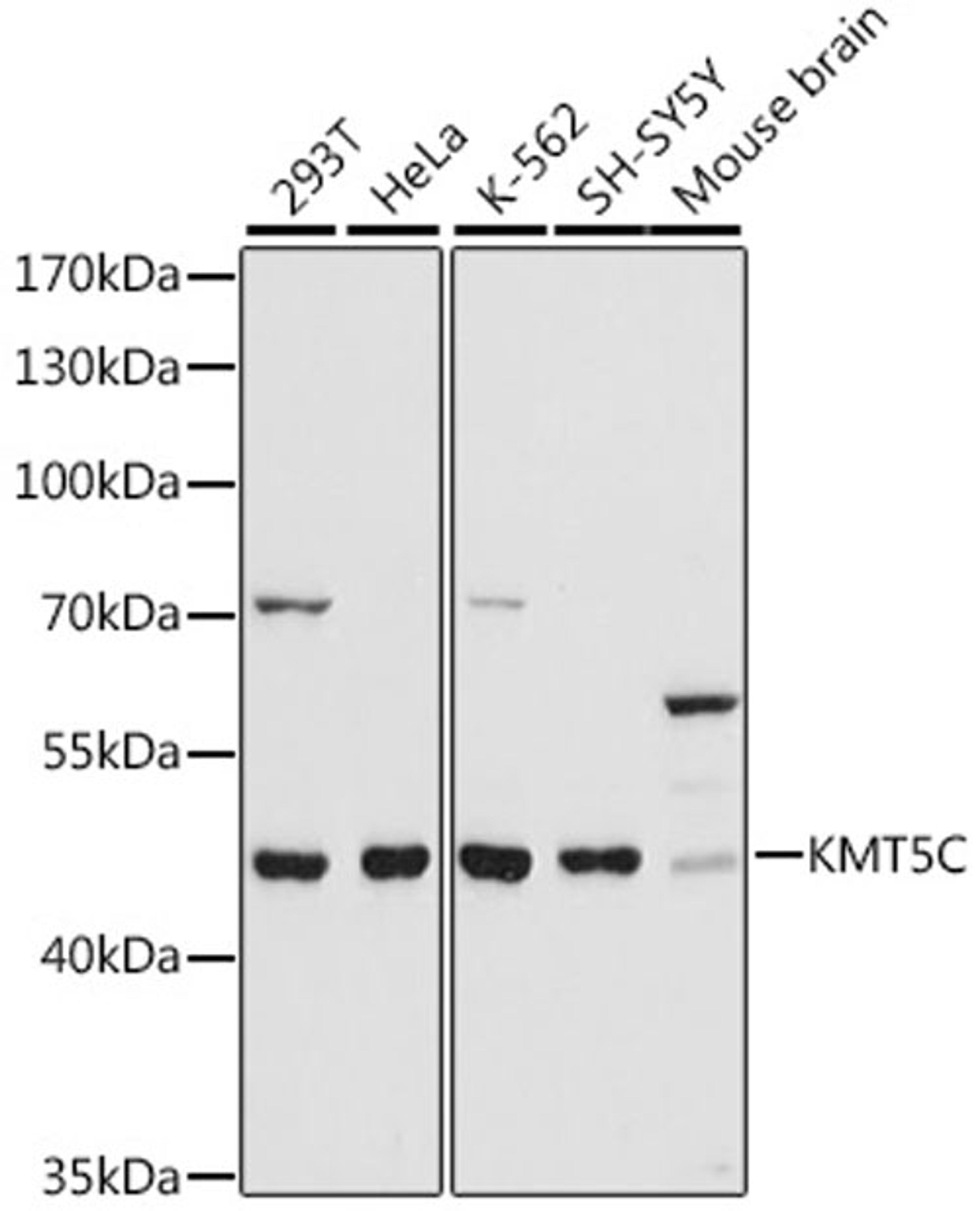 Western blot - KMT5C antibody (A16235)