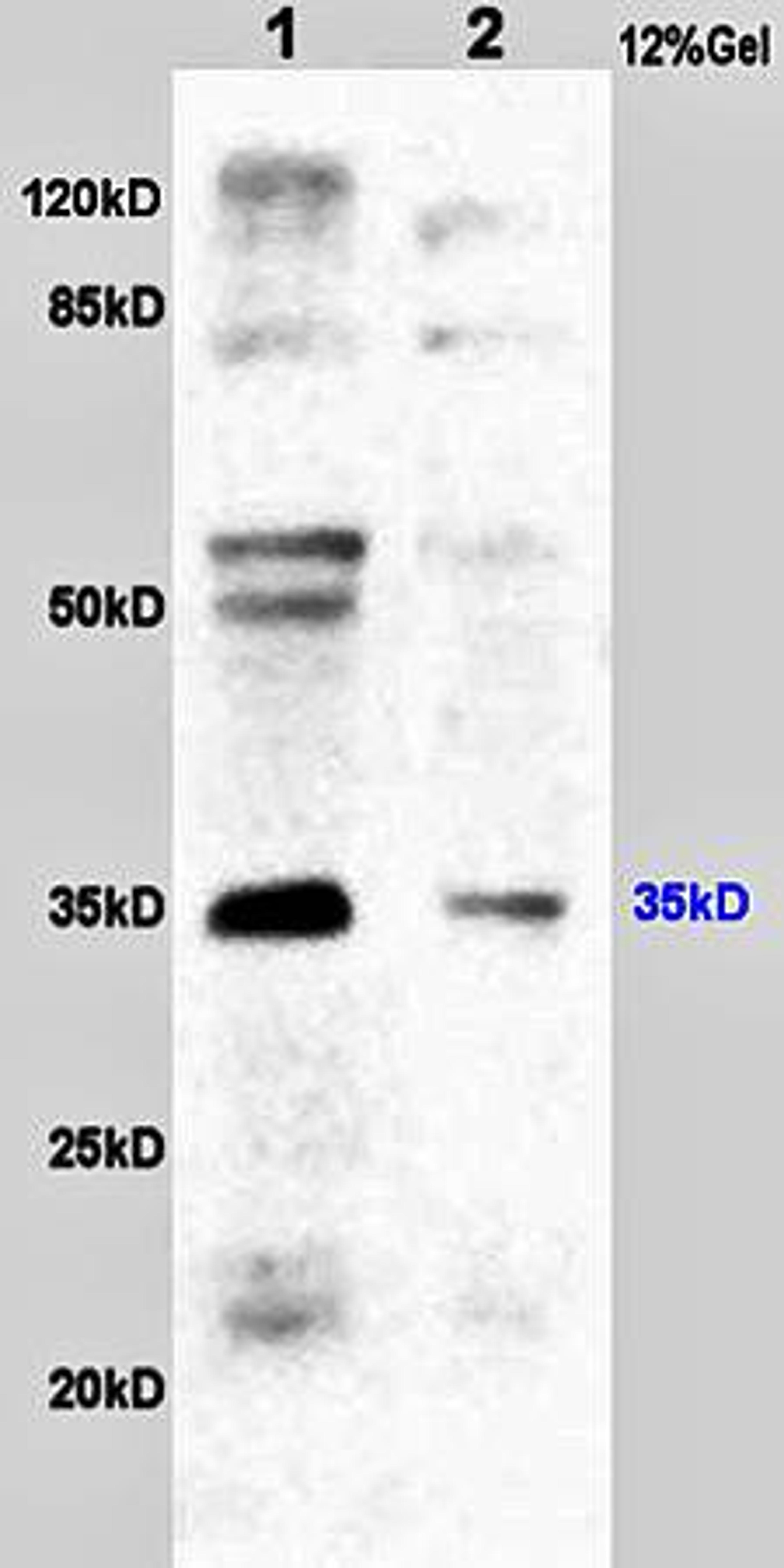 Western blot analysis of human colon carcinoma lysates(Lane1),rat heart lysates(Lane2) using CD24 antibody