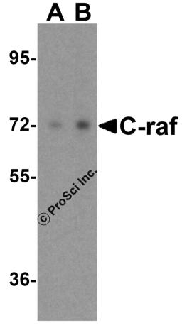 Western blot analysis of C-raf in A431 cell lysate with NPC1 antibody at (A) 0.5 and (B) 1 &#956;g/mL.