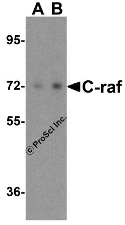 Western blot analysis of C-raf in A431 cell lysate with NPC1 antibody at (A) 0.5 and (B) 1 μg/mL.