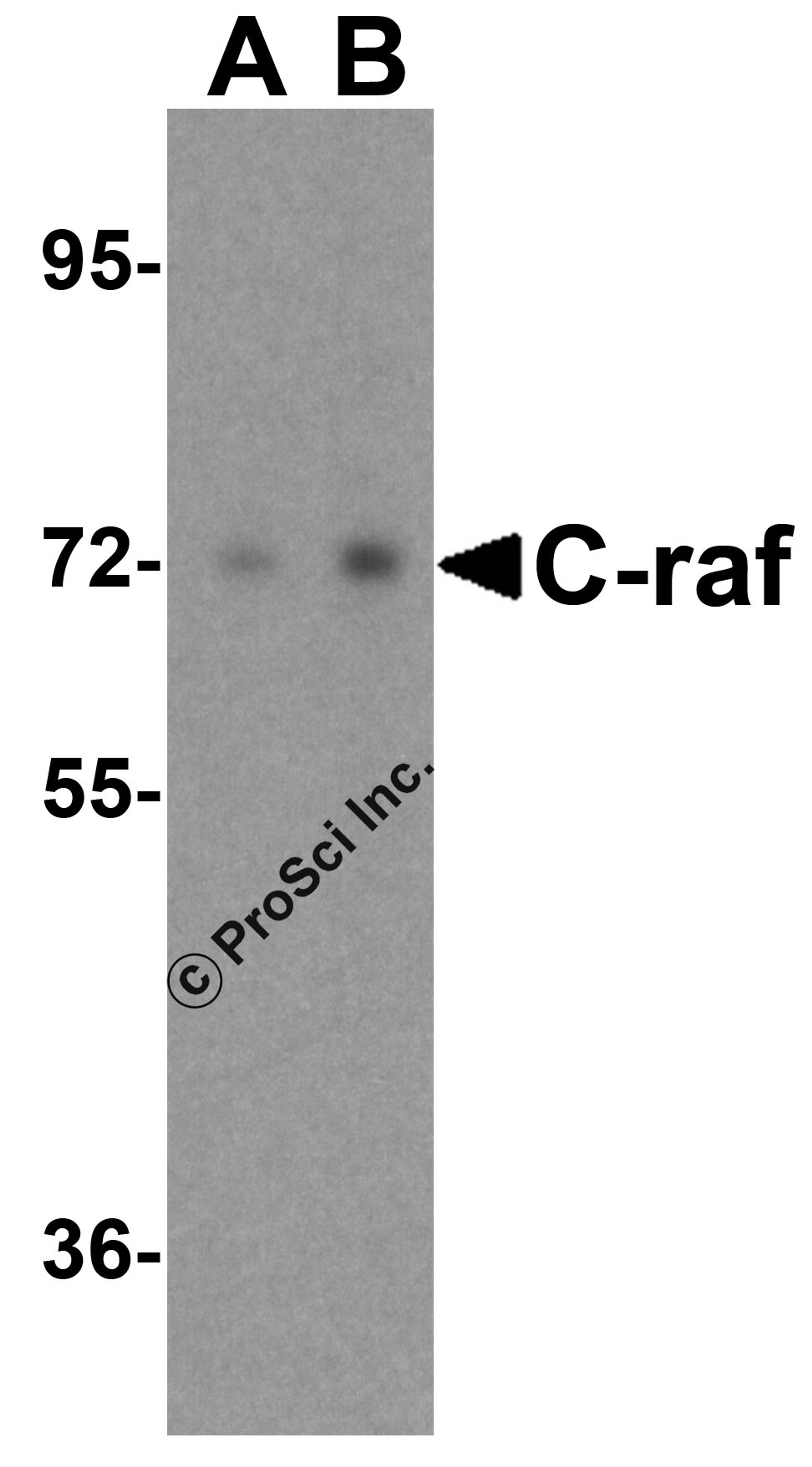 Western blot analysis of C-raf in A431 cell lysate with NPC1 antibody at (A) 0.5 and (B) 1 μg/mL.