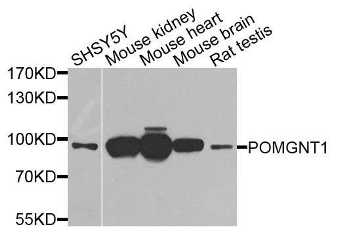 Western blot analysis of extracts of various cells using POMGNT1 antibody