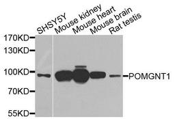 Western blot analysis of extracts of various cells using POMGNT1 antibody