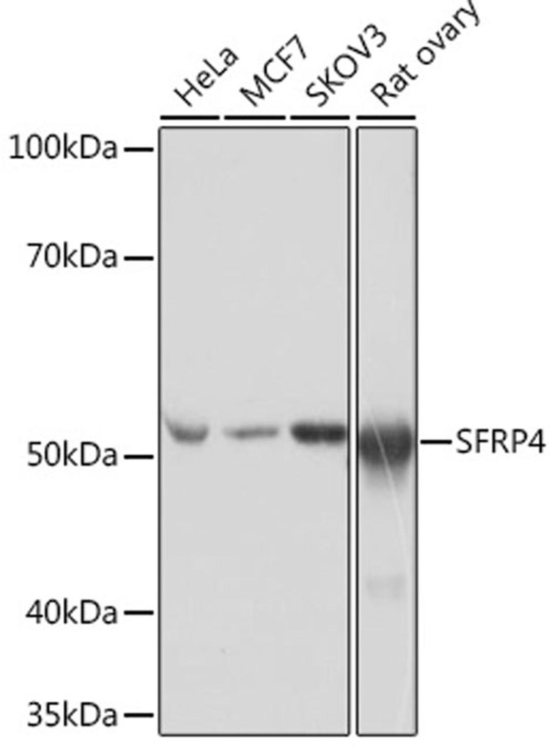 Western blot - SFRP4 Rabbit mAb (A4189)