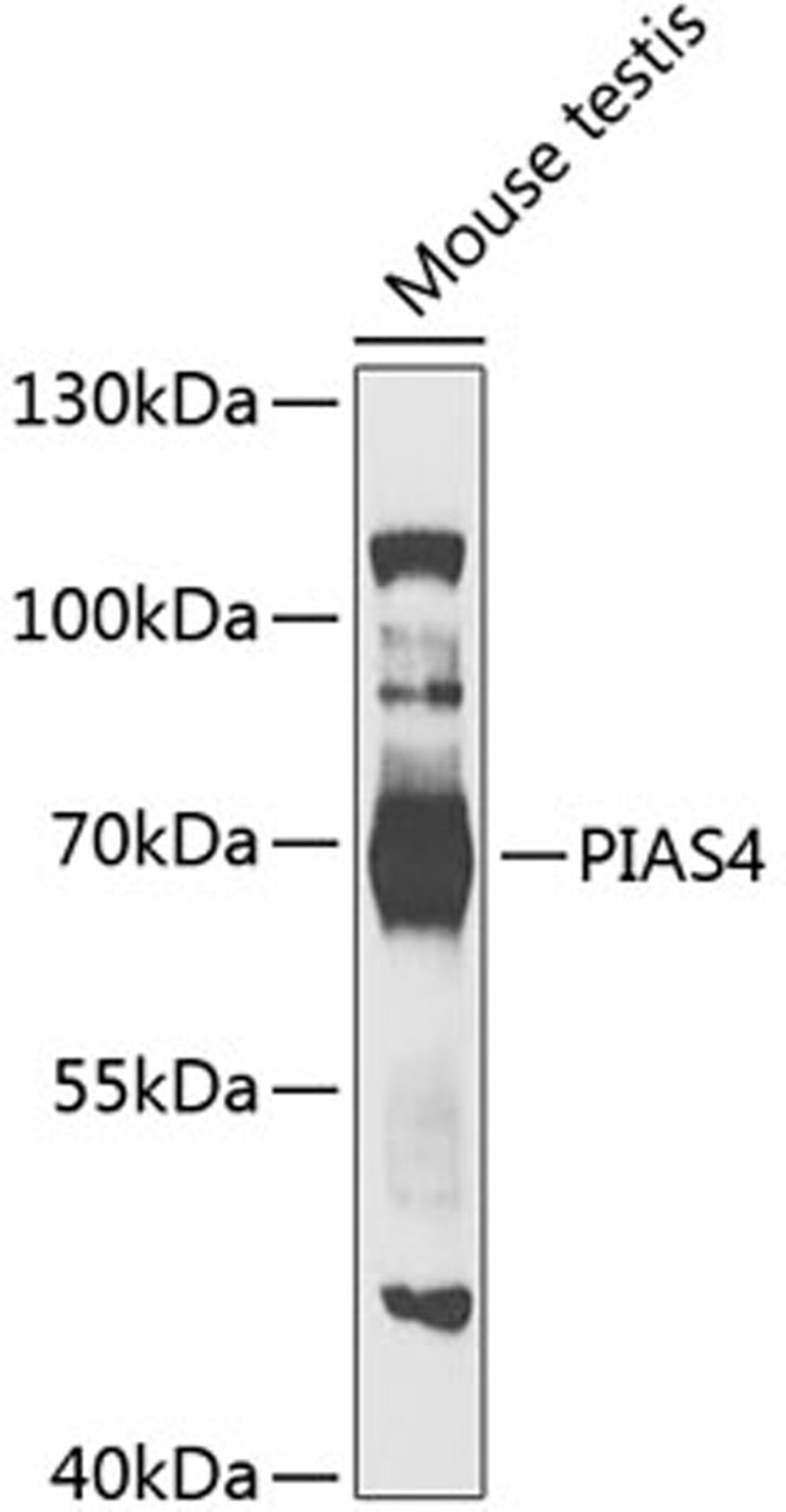 Western blot - PIAS4 antibody (A5322)