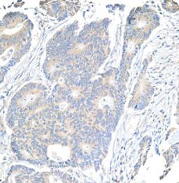 Detection of human Notch1 by immunohistochemistry.