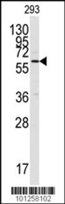 Western blot analysis of anti-CAMK2 alpha C-term Pab in 293 cell lysate. CAMK2 alpha was detected using purified Pab.