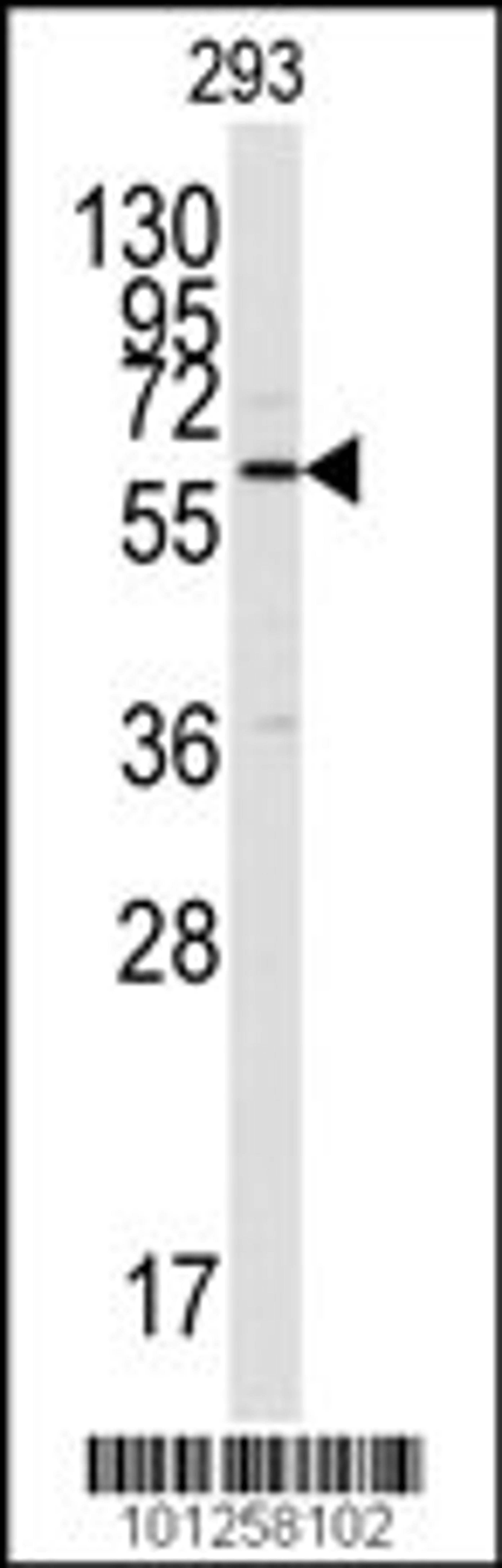 Western blot analysis of anti-CAMK2 alpha C-term Pab in 293 cell lysate. CAMK2 alpha was detected using purified Pab.