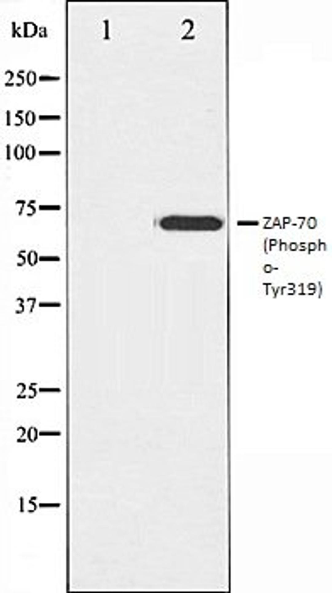 Western blot analysis of Jurkat whole cell lysates using ZAP-70 (Phospho-Tyr319) antibody, The lane on the left is treated with the antigen-specific peptide.