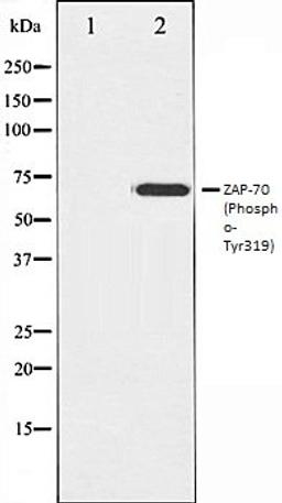 Western blot analysis of Jurkat whole cell lysates using ZAP-70 (Phospho-Tyr319) antibody, The lane on the left is treated with the antigen-specific peptide.