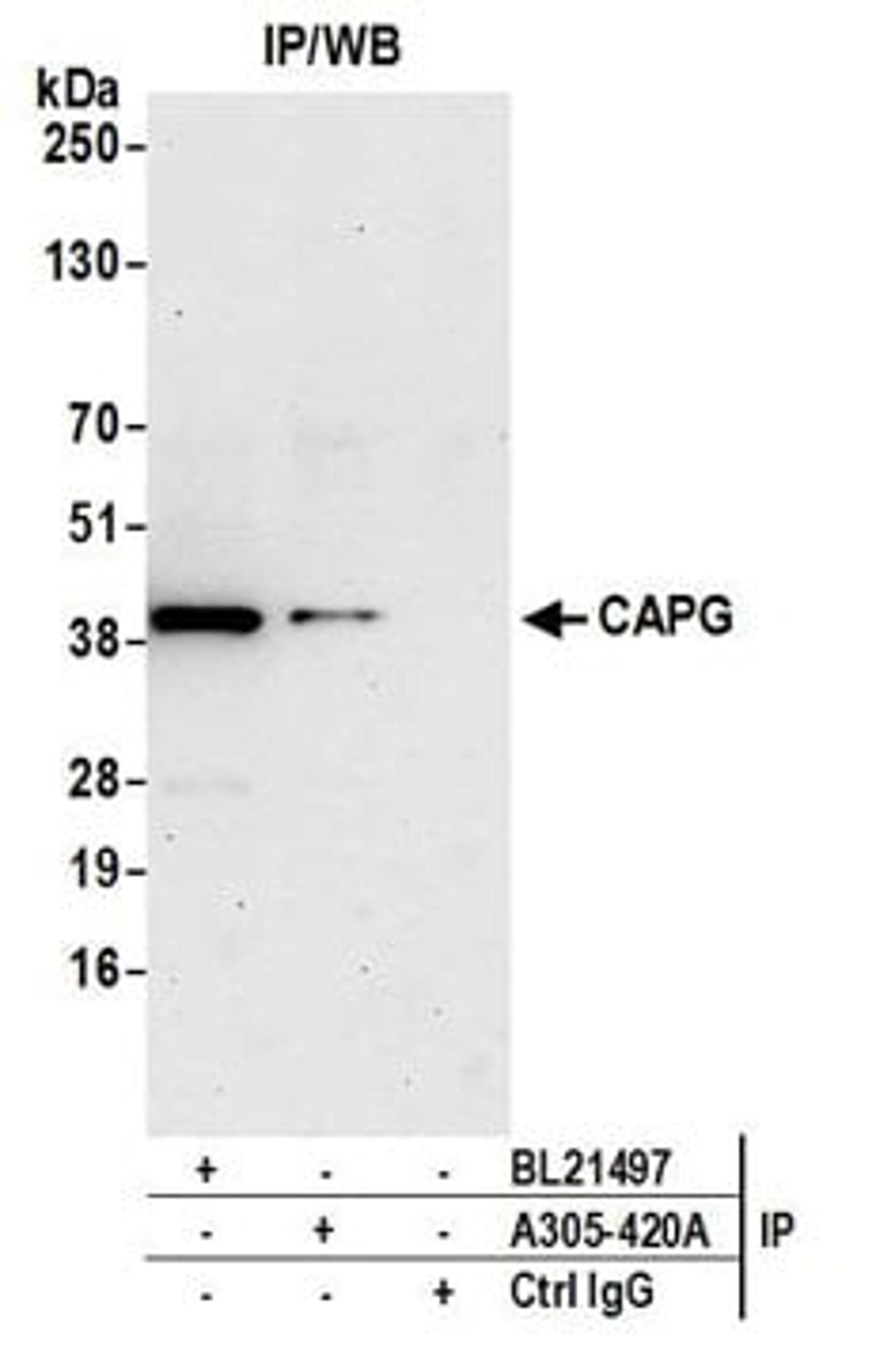 Detection of human CAPG by western blot of immunoprecipitates.