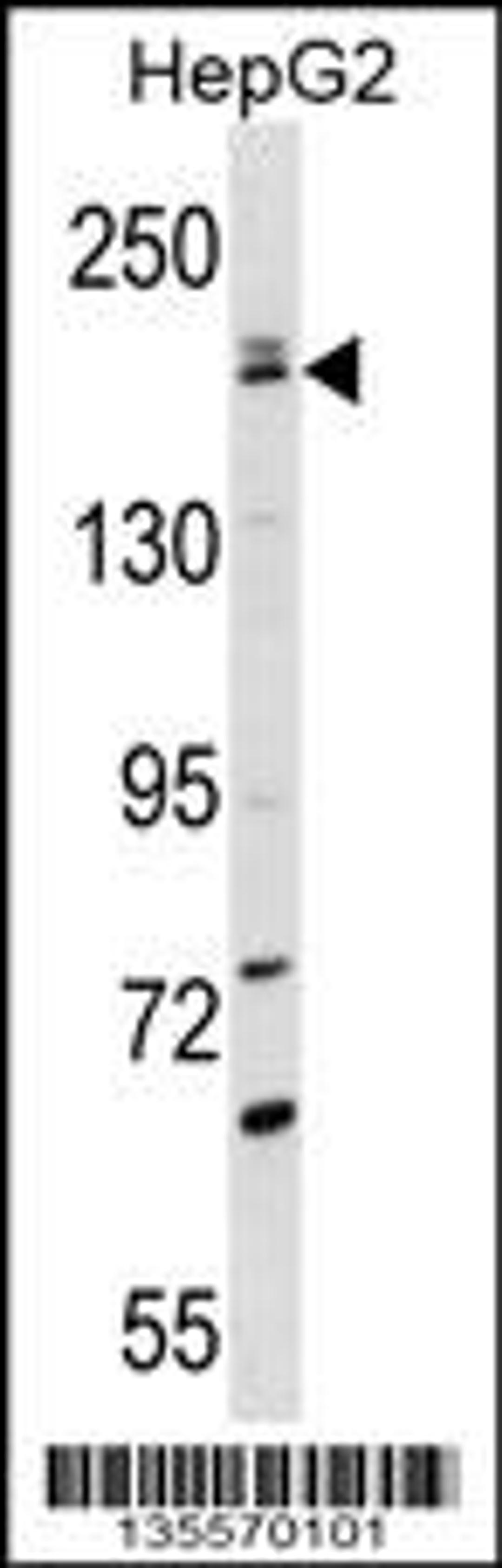 Western blot analysis in HepG2 cell line lysates (35ug/lane).