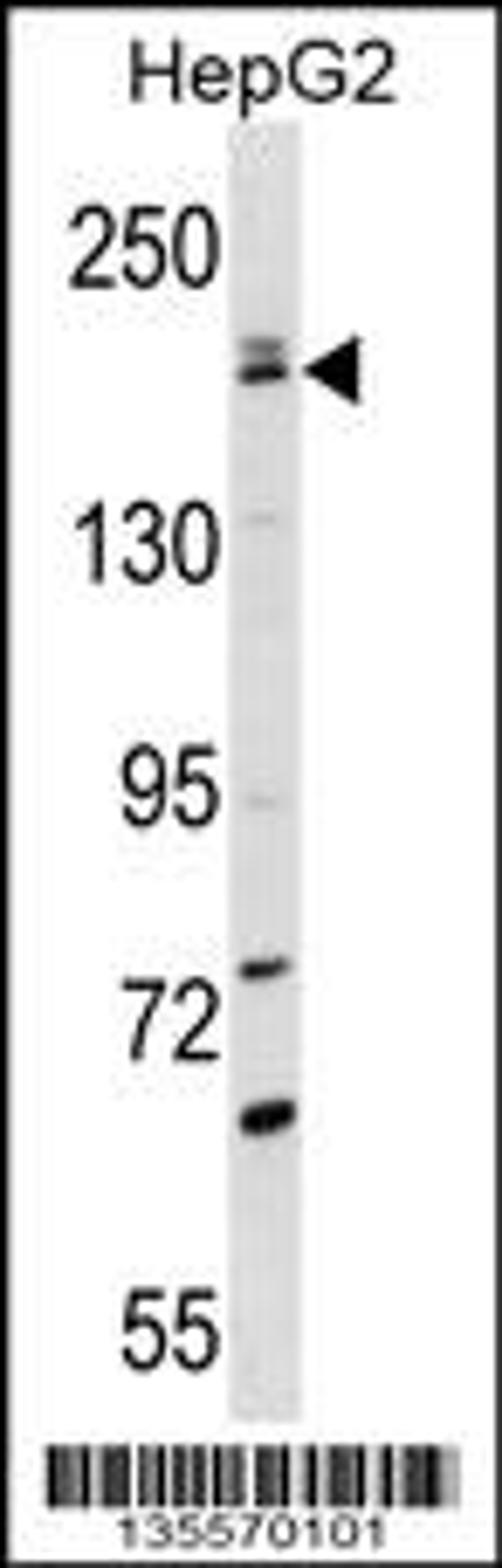 Western blot analysis in HepG2 cell line lysates (35ug/lane).