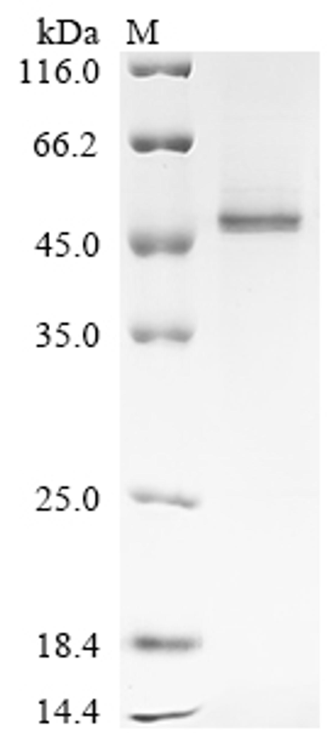 (Tris-Glycine gel) Discontinuous SDS-PAGE (reduced) with 5% enrichment gel and 15% separation gel.