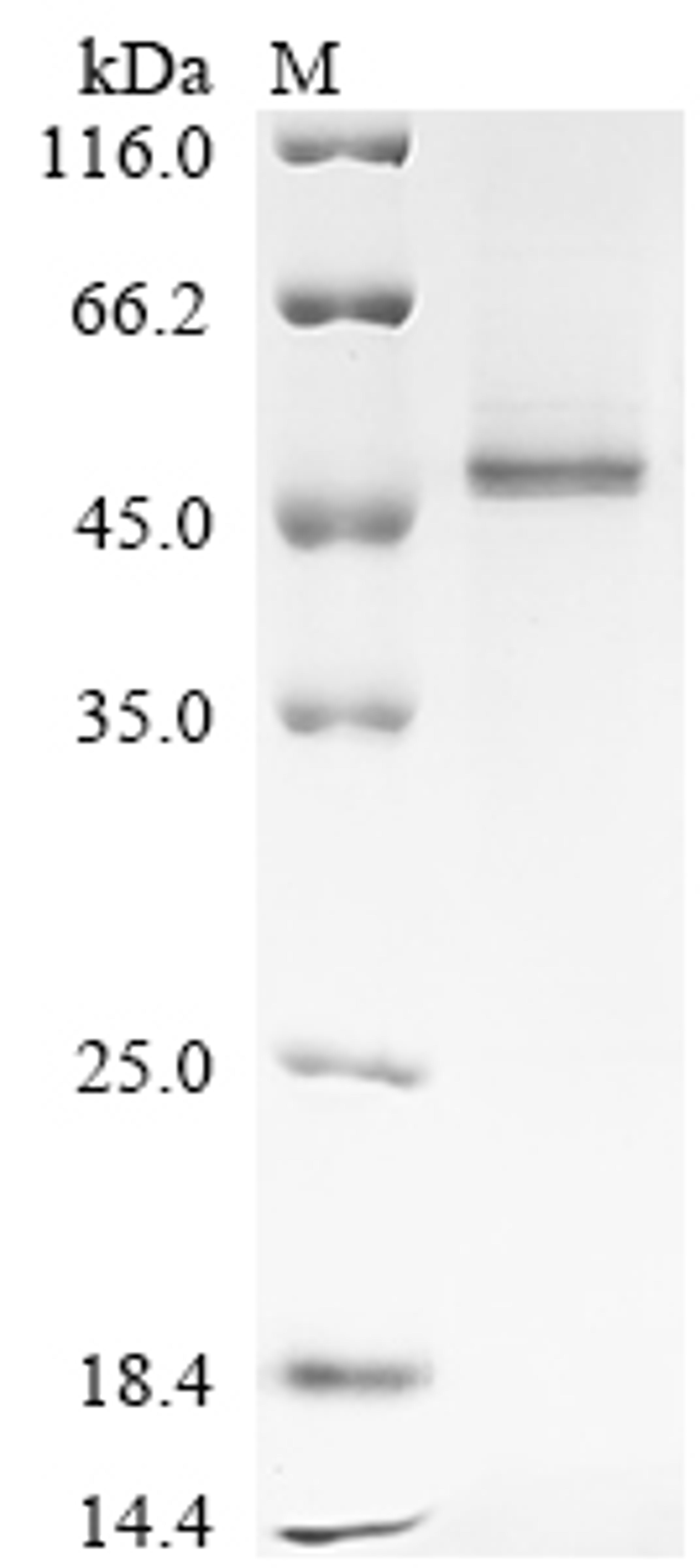 (Tris-Glycine gel) Discontinuous SDS-PAGE (reduced) with 5% enrichment gel and 15% separation gel.
