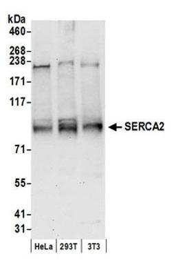 Detection of human and mouse SERCA2 by western blot.