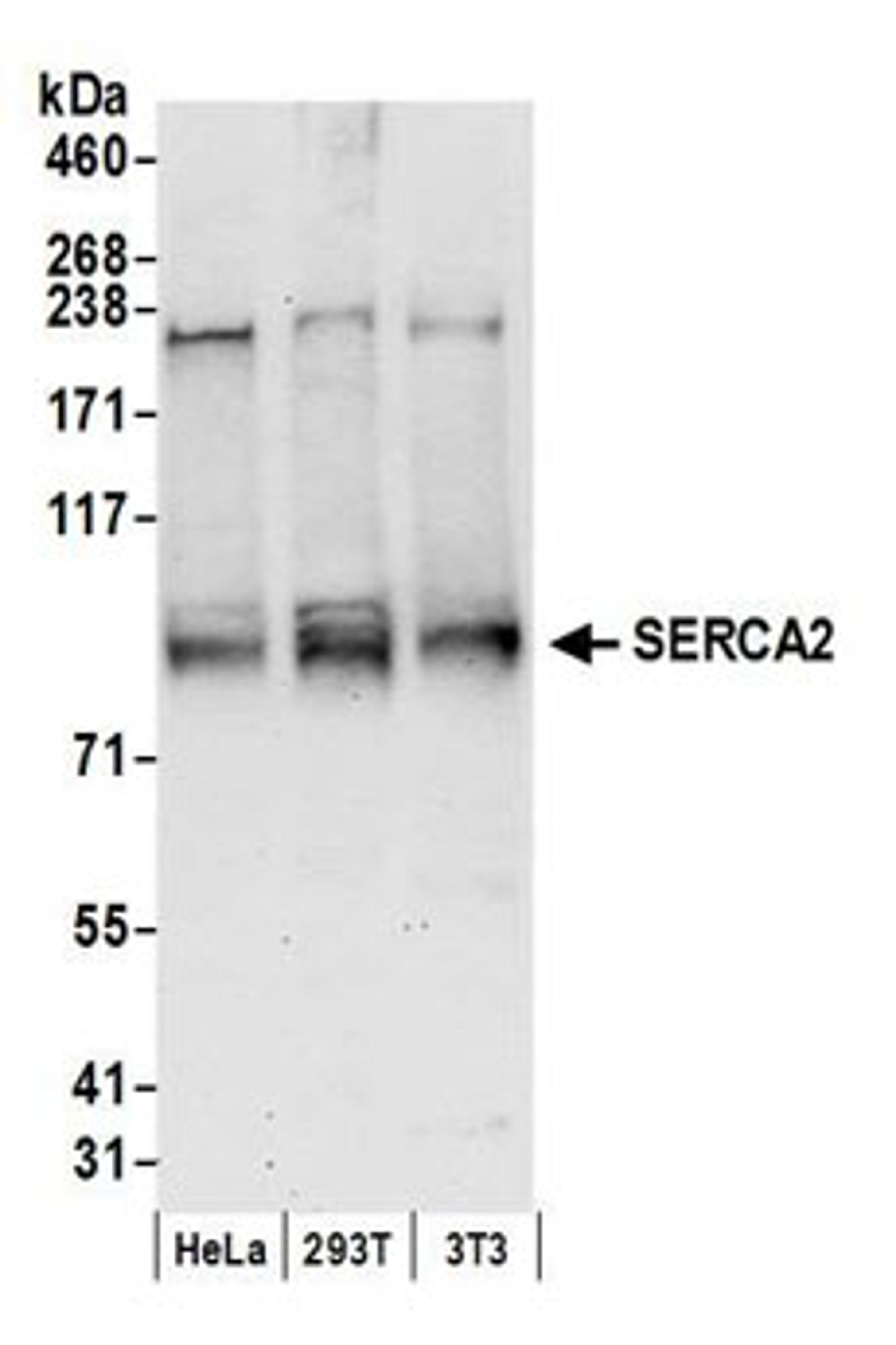 Detection of human and mouse SERCA2 by western blot.