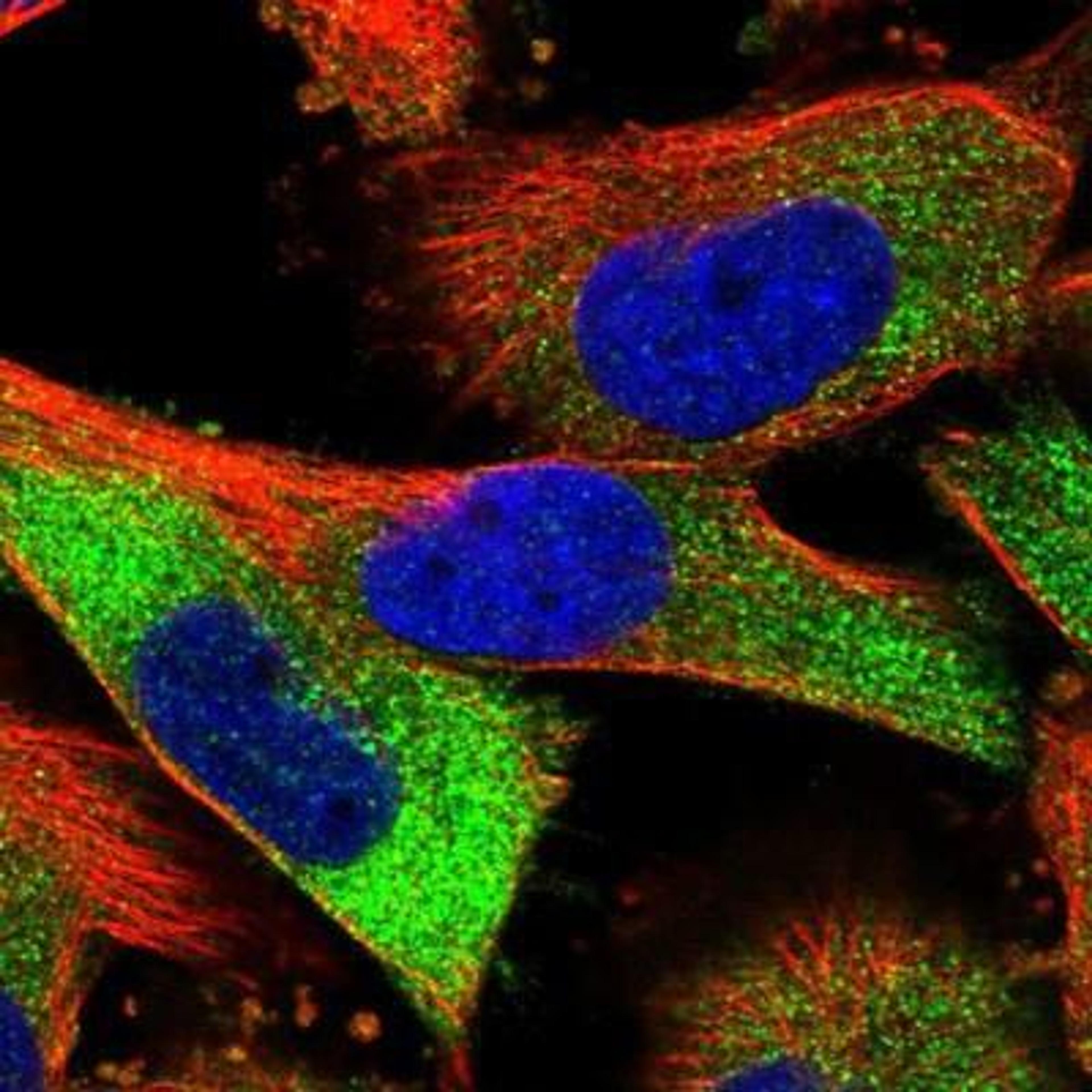 Immunocytochemistry/Immunofluorescence: Stabilin-2 Antibody [NBP1-84197] - Staining of human cell line U-251MG shows positivity in cytoplasm.