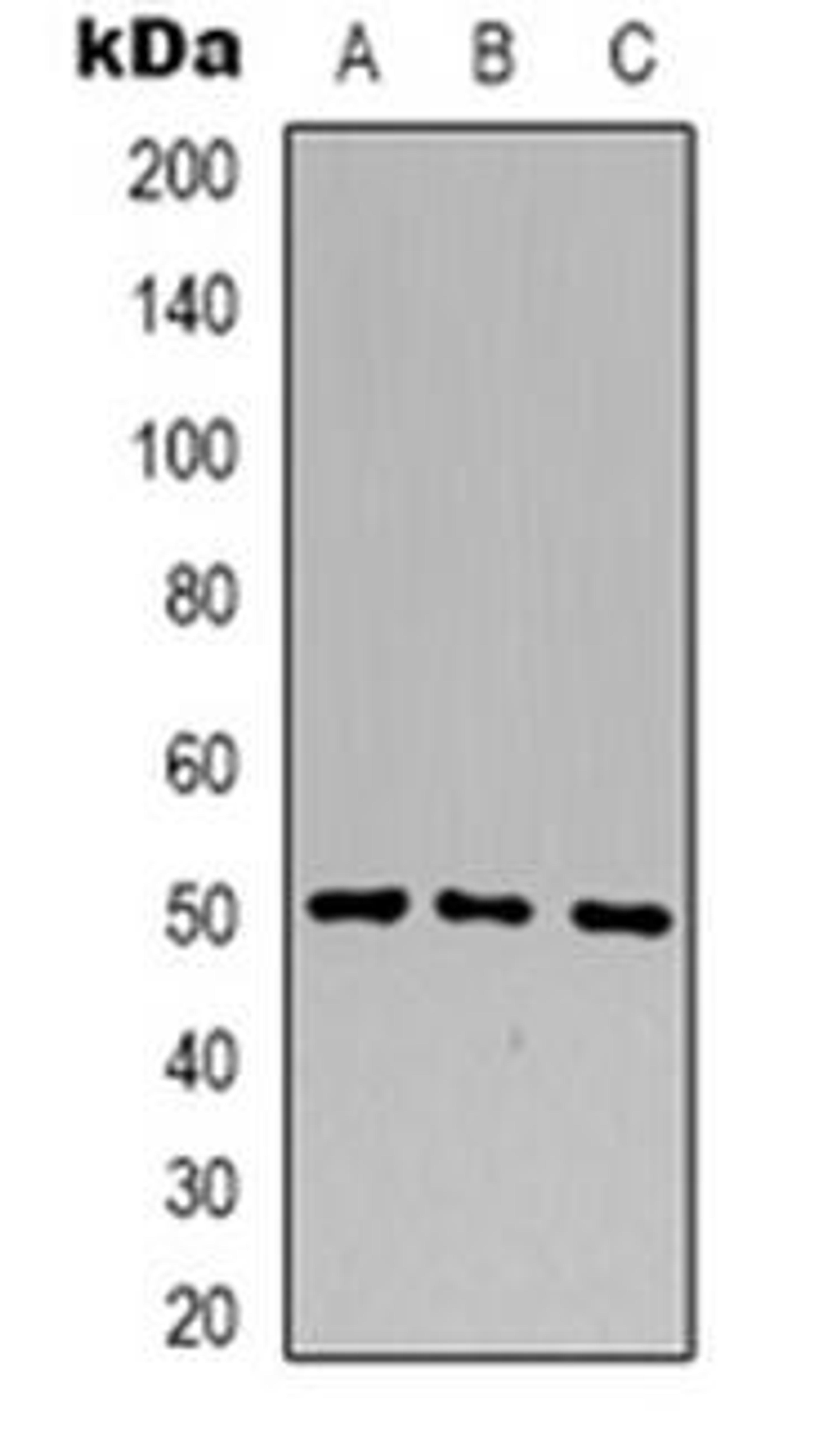 Western blot analysis of B4GALT1 expression in HL60 (Lane 1), HEK293T (Lane 2), Jurkat (Lane 3) whole cell lysates using B4GALT1 antibody