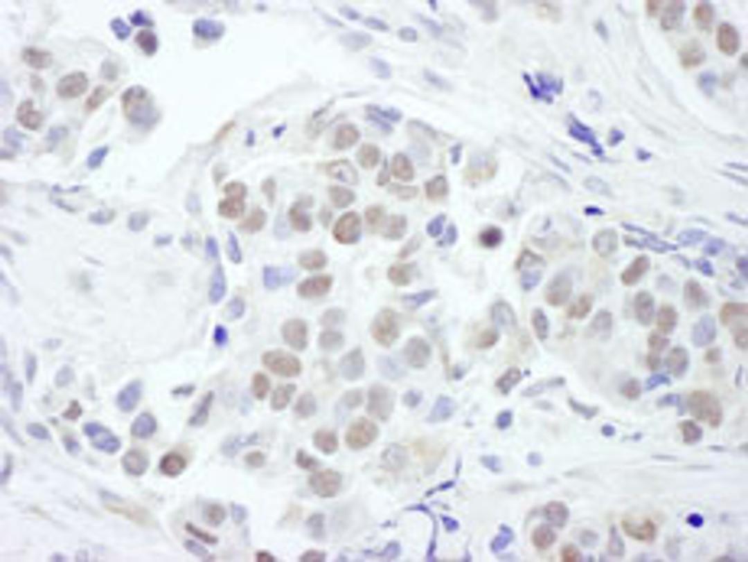 Detection of human GATA3 by immunohistochemistry.