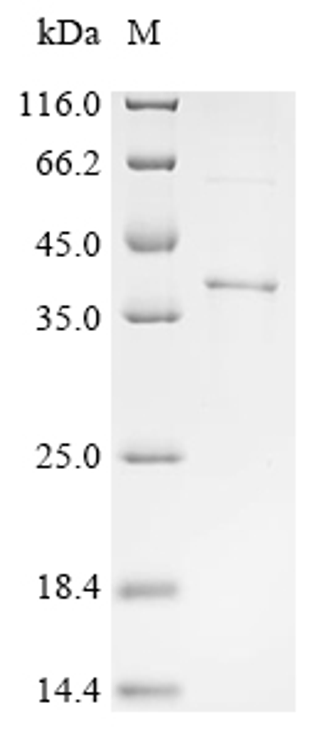 (Tris-Glycine gel) Discontinuous SDS-PAGE (reduced) with 5% enrichment gel and 15% separation gel.