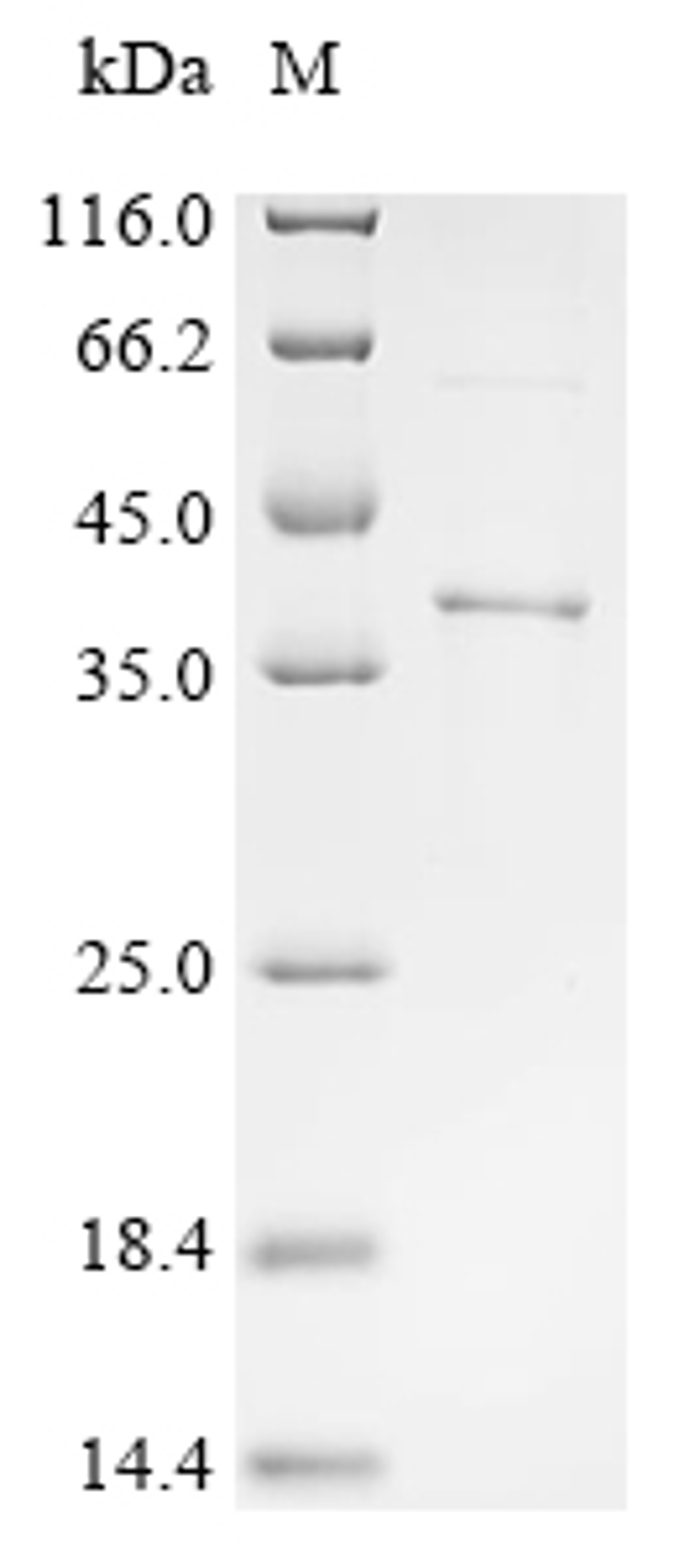 (Tris-Glycine gel) Discontinuous SDS-PAGE (reduced) with 5% enrichment gel and 15% separation gel.