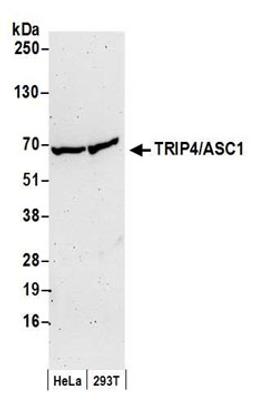 Detection of human TRIP4/ASC1 by western blot.