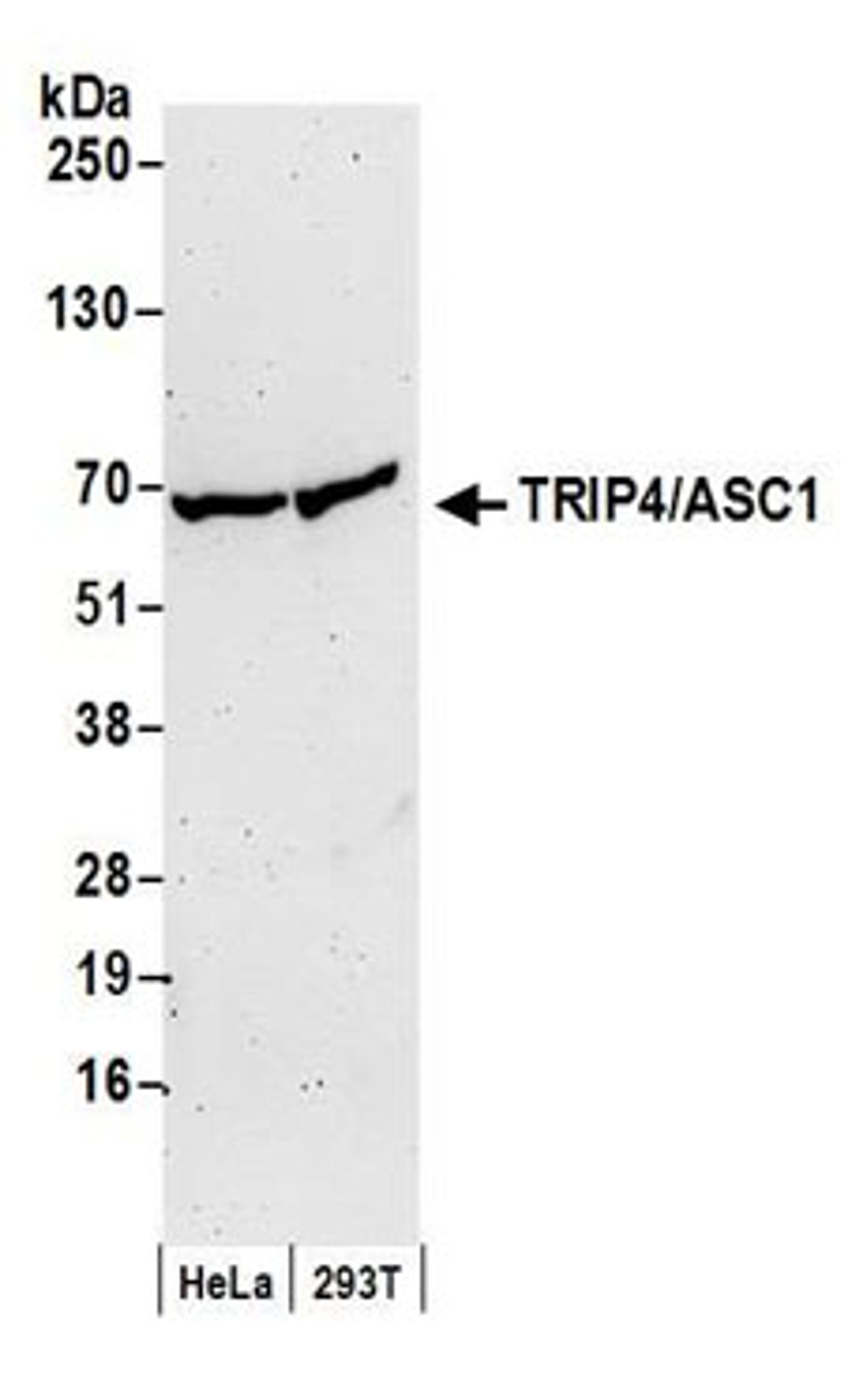 Detection of human TRIP4/ASC1 by western blot.