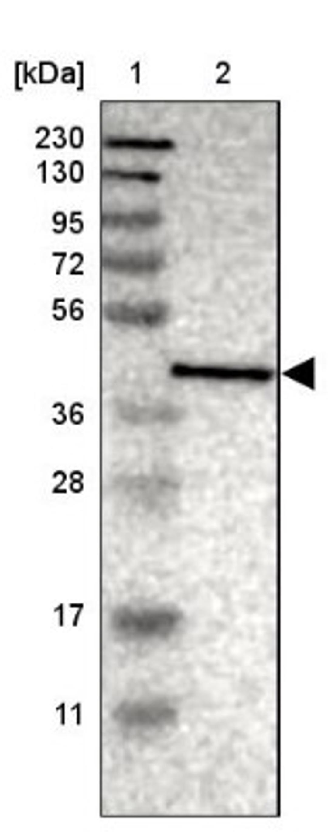 Western Blot: PHF11 Antibody [NBP1-88684] - Lane 1: Marker [kDa] 230, 130, 95, 72, 56, 36, 28, 17, 11<br/>Lane 2: Human cell line RT-4