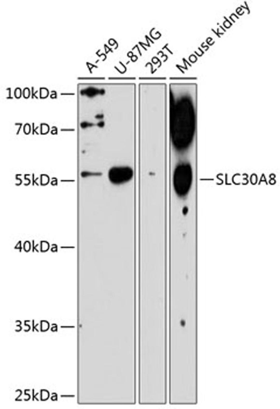 Western blot - SLC30A8 antibody (A1679)