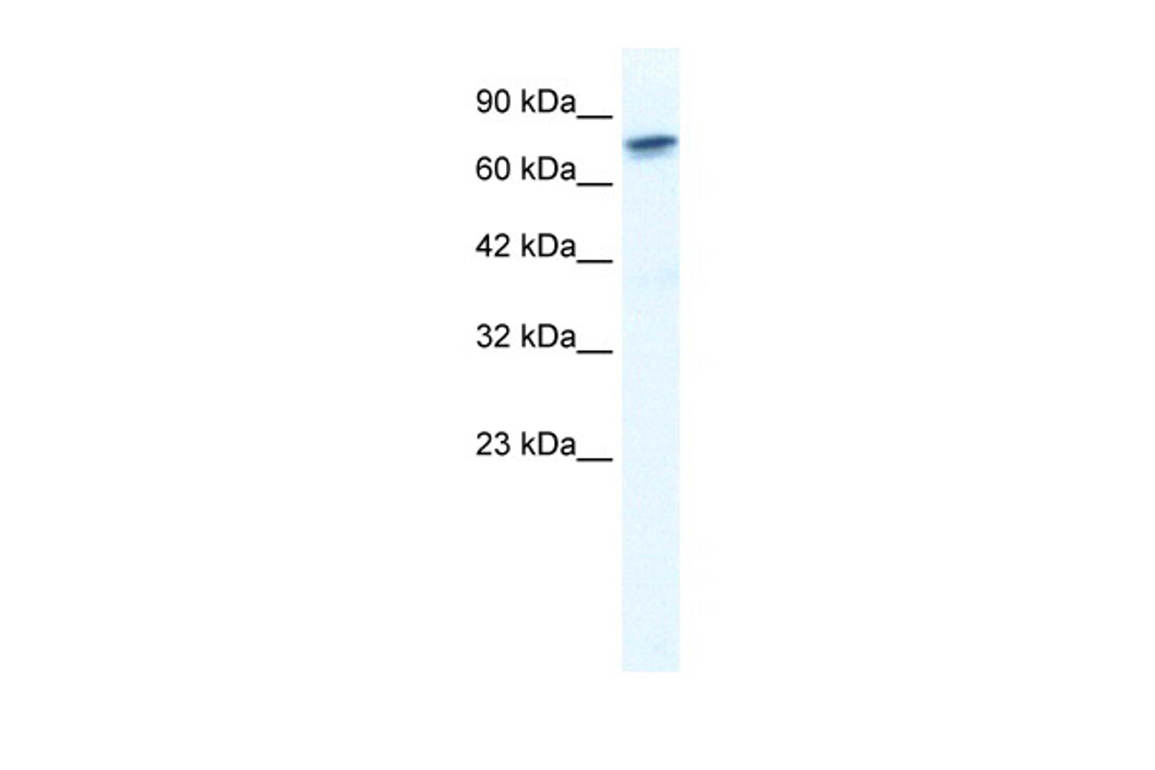 Antibody used in WB on Human HepG2 at 1.25 ug/ml.