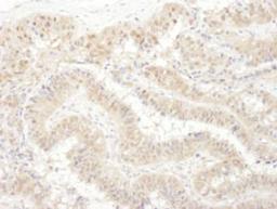 Detection of human PSMC4 by immunohistochemistry.