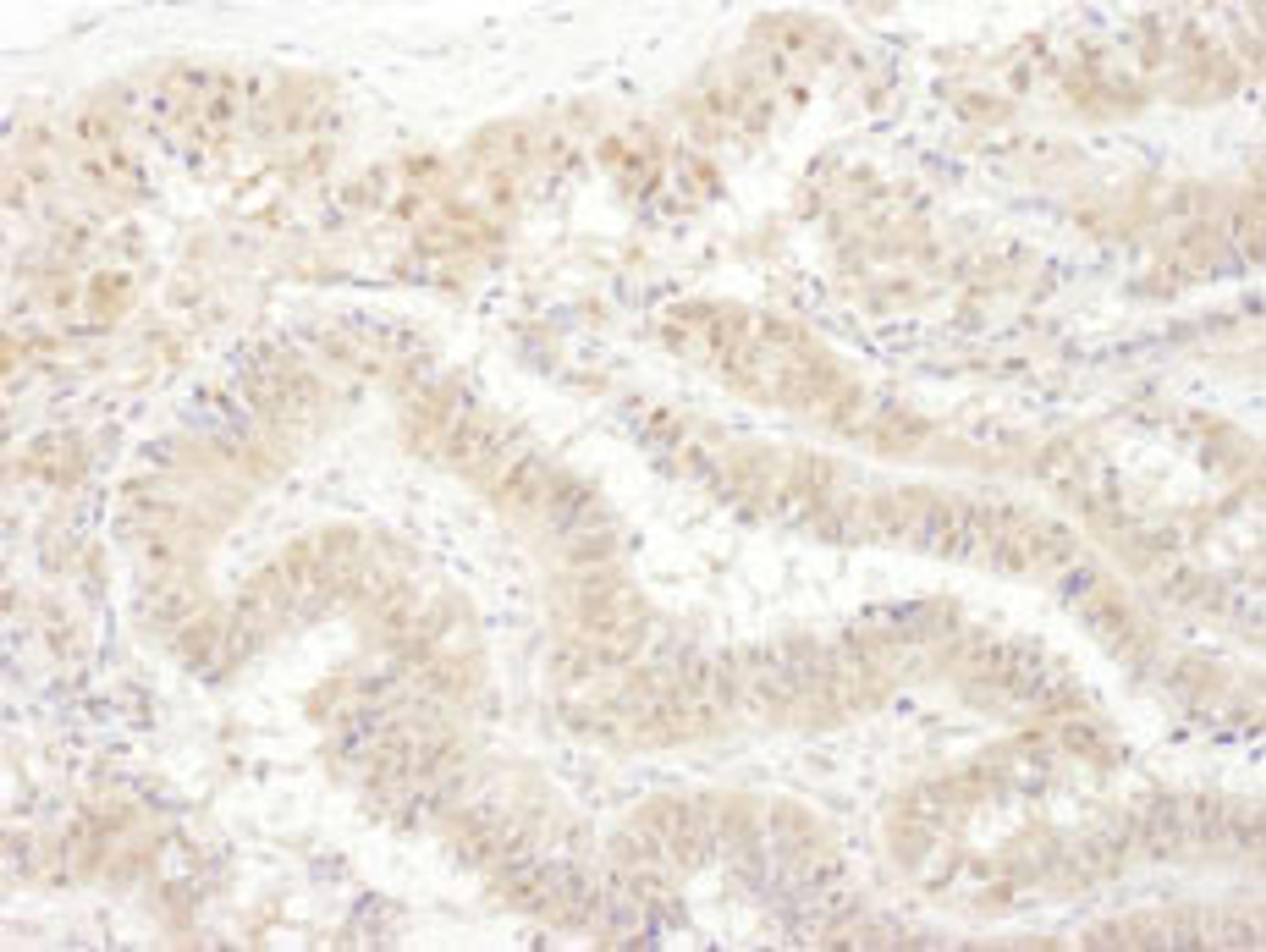 Detection of human PSMC4 by immunohistochemistry.