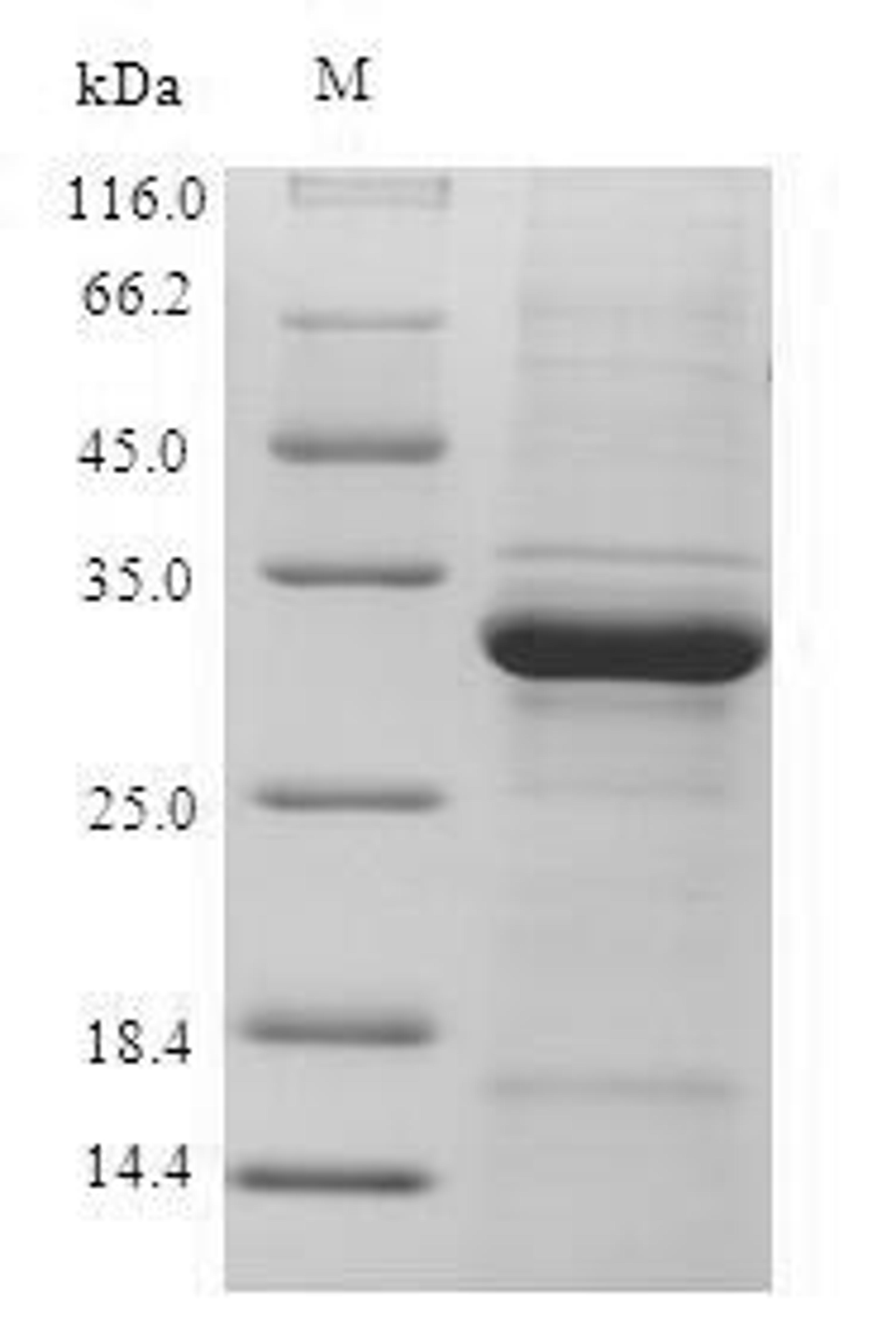 (Tris-Glycine gel) Discontinuous SDS-PAGE (reduced) with 5% enrichment gel and 15% separation gel.