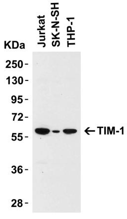 <strong>Figure 1 Western Blot Validation in Human Cell Lines</strong><br>
Loading: 15 &#956;g of lysates per lane.
Antibodies: TIM-1 3811 (1 &#956;g /mL), 1 h incubation at RT in 5% NFDM/TBST.
Secondary: Goat anti-rabbit IgG HRP conjugate at 1:10000 dilut