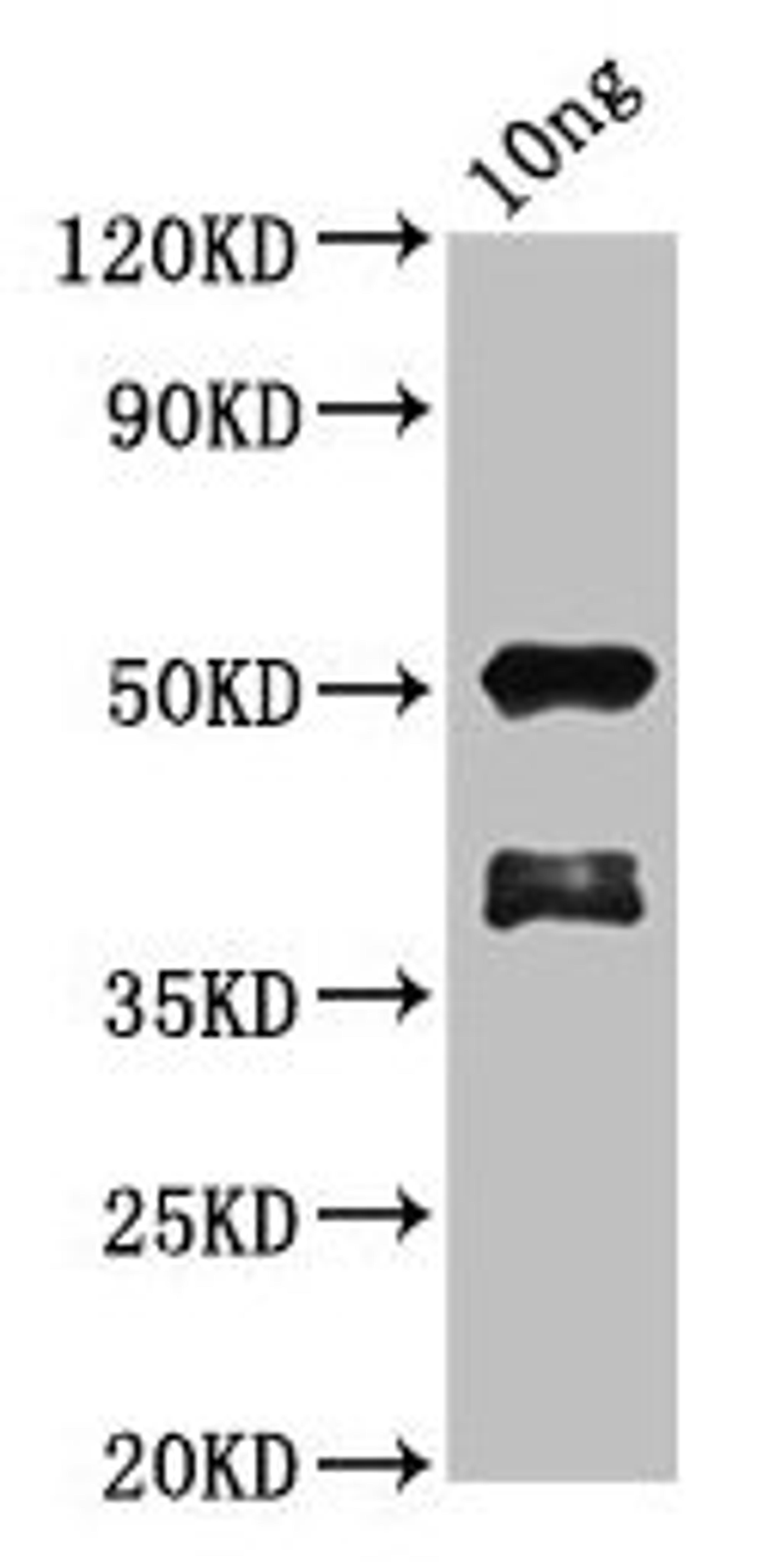 Western Blot. Positive WB detected in Recombinant protein. All lanes: brca2 antibody at 1.7µg/ml. Secondary. Goat polyclonal to rabbit IgG at 1/50000 dilution. Predicted band size: 45 kDa. Observed band size: 52 kDa