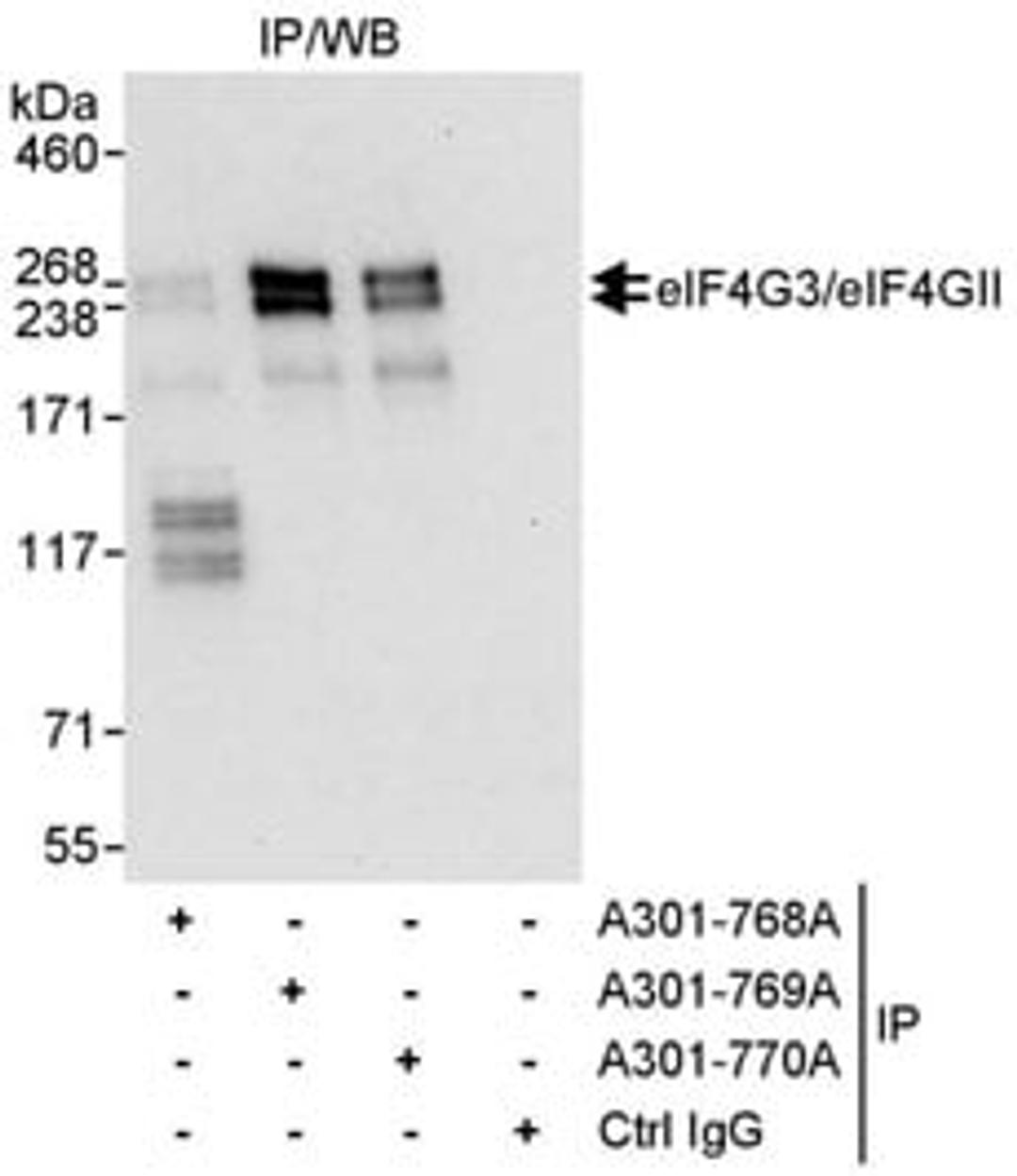 Detection of human eIF4G3/eIF4GII by western blot of immunoprecipitates.